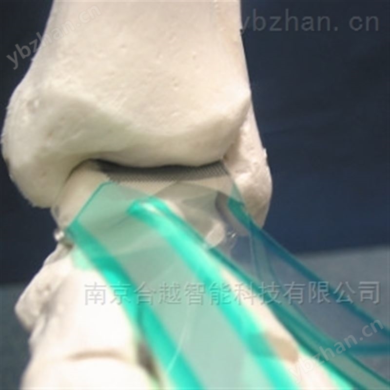 骨关节压力分布测量系统-压力分布检测系统