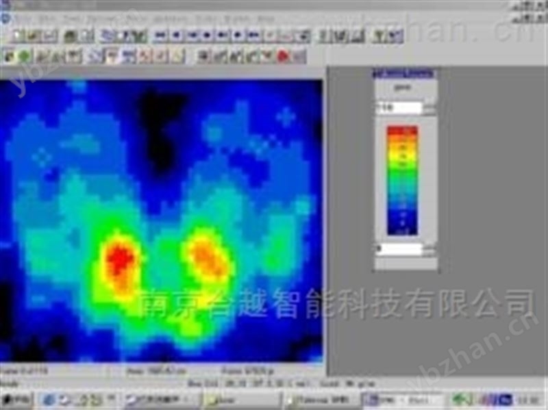 BPMS人体压力分布测量系统-压力分布检测系统