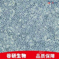 LWnt-3A 细胞专用培养基
