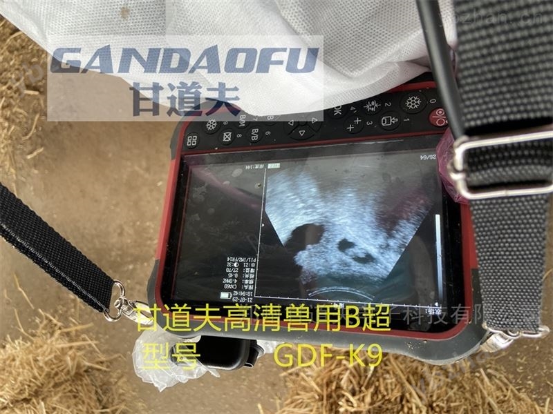 高清骆驼B超测孕仪价格报价